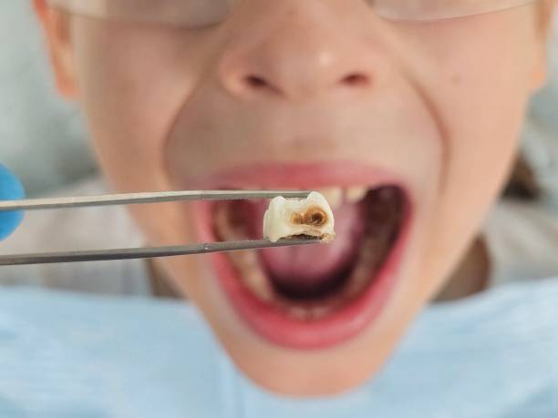 Best Weekend Emergency Dentist in Fairview, CA